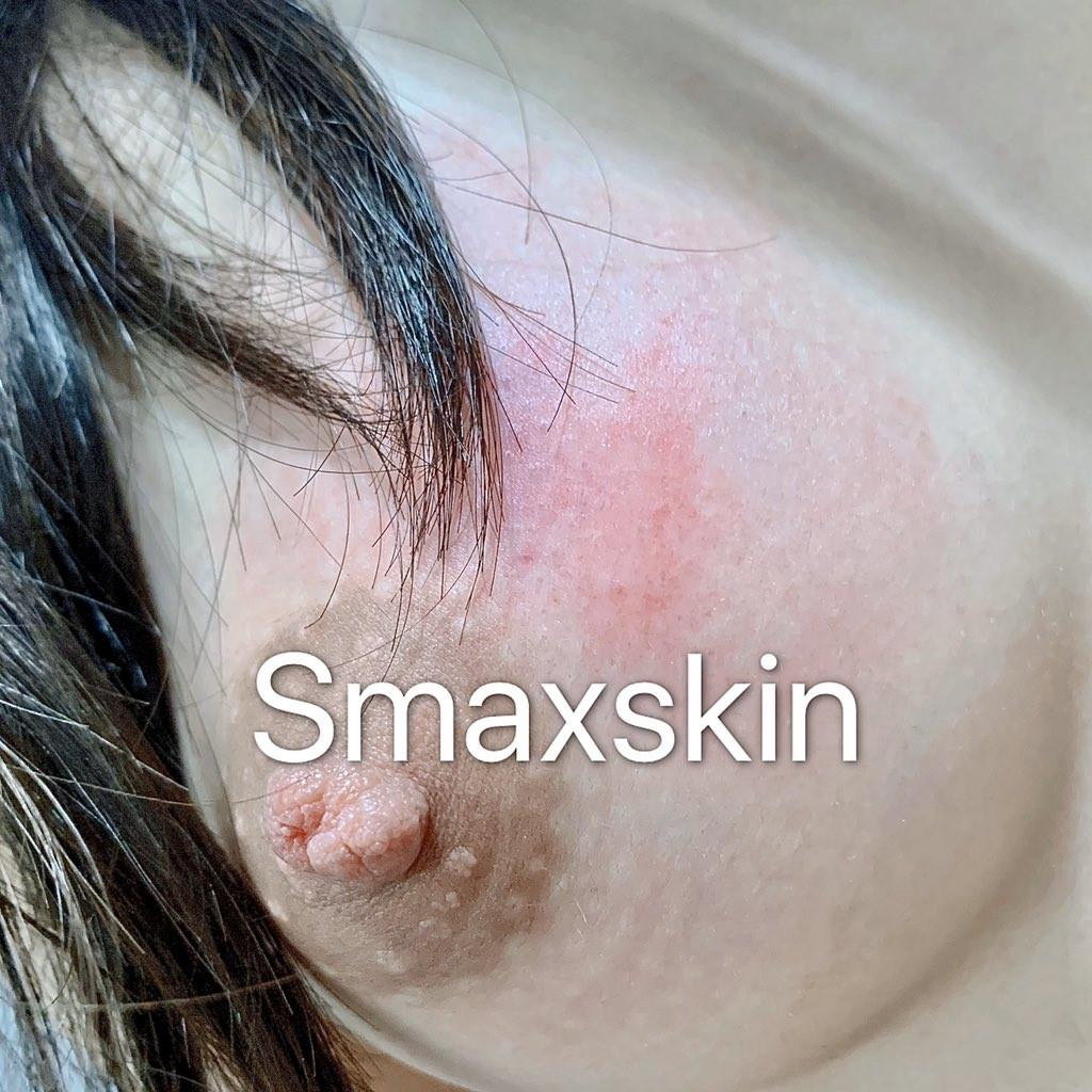 Smaxskin写真